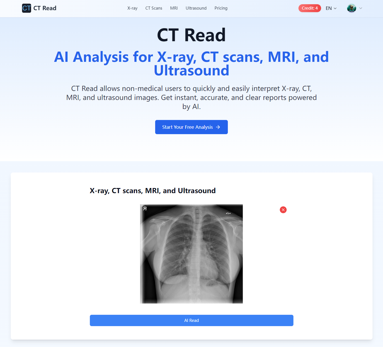 CT Read 截图