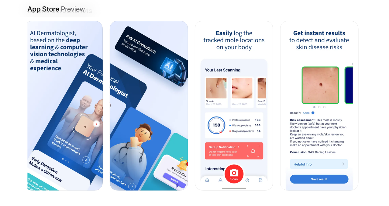 AI Dermatologist 截图